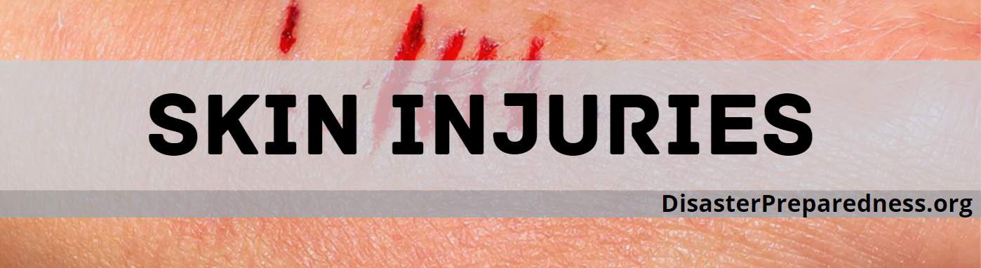 Skin Injuries